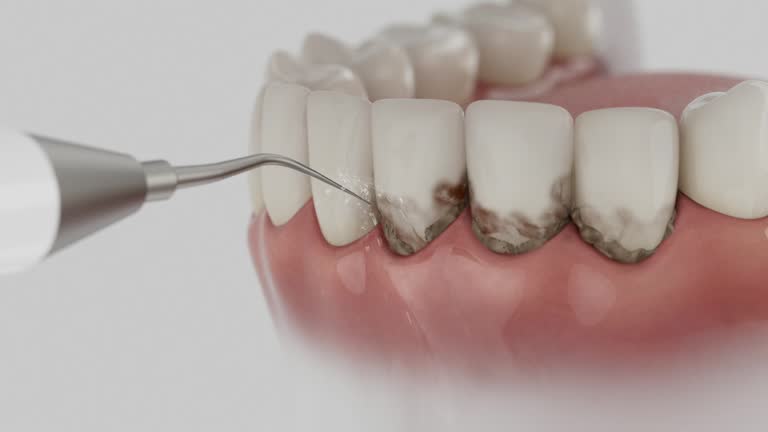 Trusted Root Canal Treatment service in Jemison, AL - Dentist Open Now